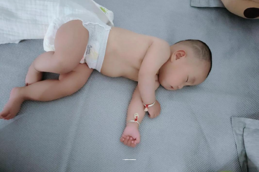 滕州六个月宝宝眼睛散光